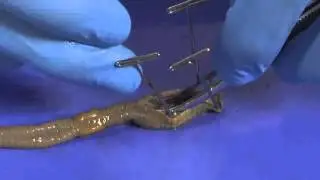 Earthworm Dissection