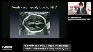ISUOG 2023 – Prof. Kiyotake Ichizuka - 2nd trimester anomaly scan using the new Technology