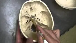 Dr. Fabian Identifying Parts of the Skull Part 2 of 2 (HD)