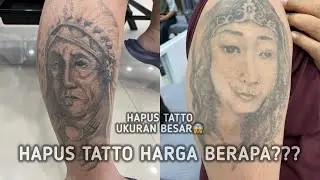Hapus Tatto besar seperti ini harga berapa ???