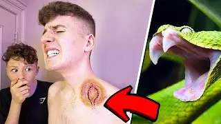 A Snake ATTACKED Me!