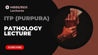 Idiopathic Thrombocytopenic Purpura Pathology Lecture MBBS BDS Second year