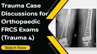 Trauma Case Discussions for Orthopaedic FRCS Exams (Trauma 4) | Orthopaedic Academy