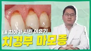 치아가 마모되는 치경부마모증, 꾸준한 관리로 해결하세요