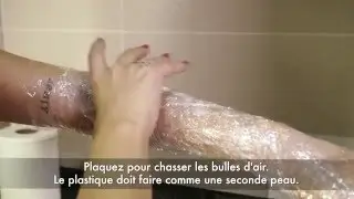 Epilation Definitive - Bras - Epilation laser à Paris