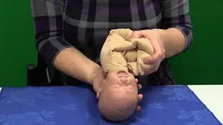 Mechanism of Occipitoposterior Labour - Short Rotation