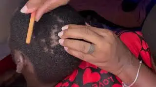 asmr , head scratching, scalp check, combing & head massage #asmrscalp