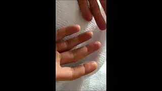 ETS AMELİYATI ÖNCESİ VE SONRASI: NELER BEKLEMELİYİZ?
