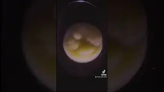 Embryogenesis