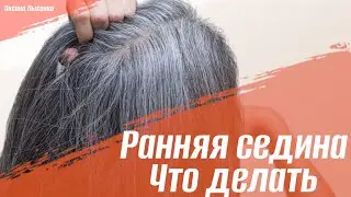 Ранняя седина