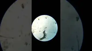 Tardigrade at 100X  | Water Bear