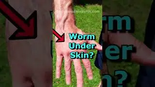 Worm Under Skin? Gigachad Vein Check |  Veiny Hands | Veins Popping Out 