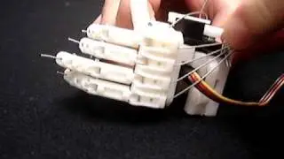 My robotic hand