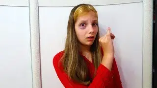 CИНЯК под глазом и сломанный палец у Иры! Кто ВИНОВАТ?