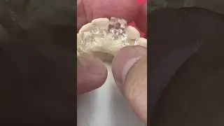 For better implants placement 