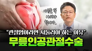 [연세사랑병원] 무릎인공관절수술, 빠르게 진행해야 하는 3가지 이유! (관절염 말기라면 필수 시청)