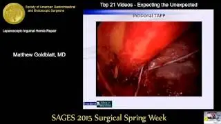 Laparoscopic Inguinal Hernia Repair