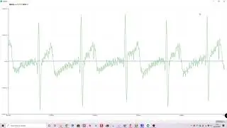 RAW ECG via UART Stream - Max30003 AFE nRF52832 MCU BLE Wearble Health Monitor Project