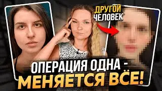 ВЕРХНЯЯ БЛЕФАРОПЛАСТИКА - СМОТРИТЕ ПЕРЕД ТЕМ, КАК ДЕЛАТЬ!