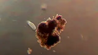 Microscopy - The Ciliate