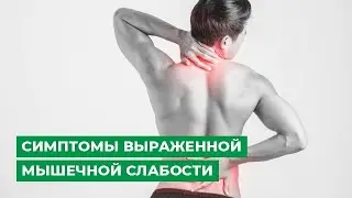 Симптомы выраженной мышечной слабости