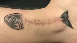 Cover Up Scars And Birthmarks With Tattoo (25 Pics)