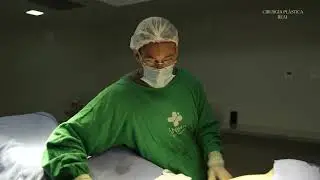 As 2 cirurgias mais comuns: 1- próteses de mama 2- abdominoplastia com lipoescultura