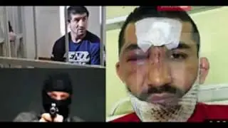 Расул Мирзаев после нападения