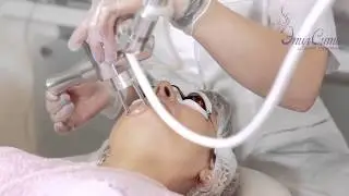 Лазерное омоложение. Салон ЭпилСити