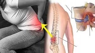 Грижани уй шароитида даволаш