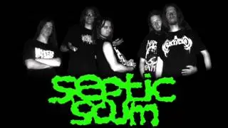 Septic Scum - Extraordinary Breastfeeding