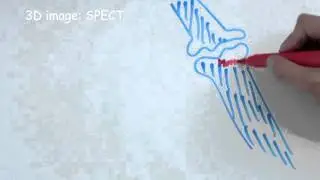 How does bone scintigraphy work?