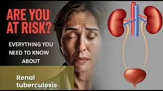 Renal tuberculosis Explained Causes, Symptoms and Treatment, All Insights