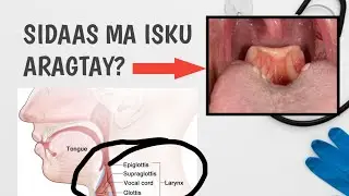 Weli Sidaas Ma isku Aragtay? ||Maanta Baro waxa ey yihin Iyo sida Loola Tacaalo || @xogocaafimaad