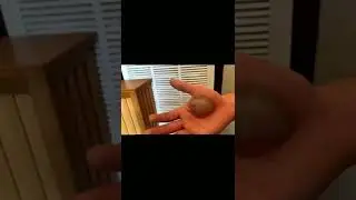 Black head removal on face - Blackheads on back treatment