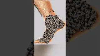 Infected foot asmr 