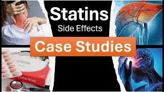 Statin Side Effects Case Studies