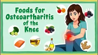Foods for Osteoarthritis of knee