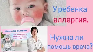 У ребенка аллергия. Нужна ли помощь врача?