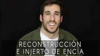 La sonrisa de Jaime: reconstrucción estética e injerto de encía