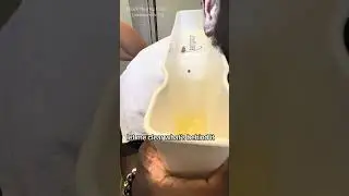 Collapsing ear canals cause earwax blockage 😬
