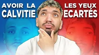 JE REPONDS AUX PIRES DILEMMES !
