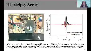 Lauren Ruger: Investigation of Ultrasound-Guided Histotripsy Methods for Canine Brain Tumor Ablation