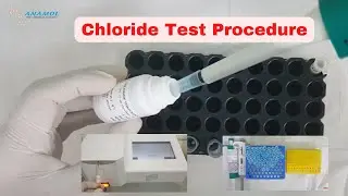 Chloride Test Procedure In Hindi | How to perform Chloride Test?