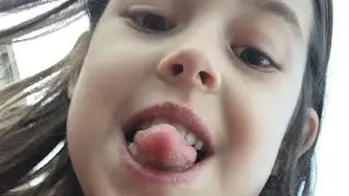Cam. B
