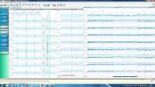 KTresult 2/3 страница ST обработка