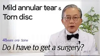Do I have to get a surgery for a mild annular tear/Annular tears heal on its own/Dr Sangho Lee