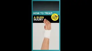 How to Treat a Burn Using a Burncare Kit (Containing Burnshield)