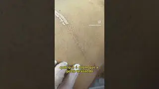 A CICATRIZ ESCURA! TEM JEITO? SIM! Claro que pra todo trabalho perfeito existe um método perfeito!😉