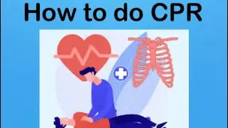 How to do CPR